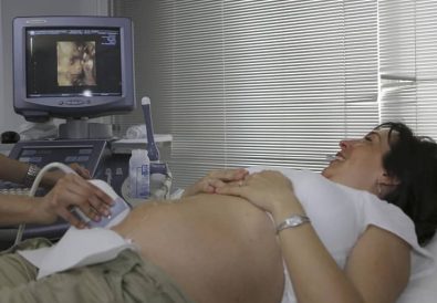 ecografie sarcină